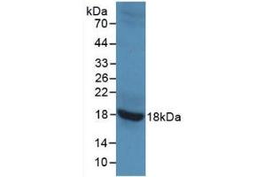 Detection of Recombinant GAD2, Rat using Monoclonal Antibody to Glutamate Decarboxylase 2 (GAD2) (GAD65 antibody)