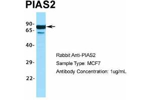 Host:  Rabbit  Target Name:  PIAS2  Sample Type:  MCF7  Antibody Dilution:  1. (PIAS2 antibody  (C-Term))