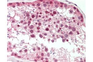 Human Testis: Formalin-Fixed, Paraffin-Embedded (FFPE). (HERC5 antibody  (AA 287-336))