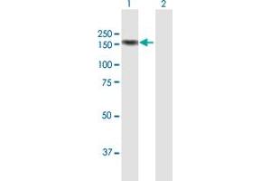 Western Blot analysis of MICALL1 expression in transfected 293T cell line by MICALL1 MaxPab polyclonal antibody. (MICAL-Like 1 antibody  (AA 1-863))
