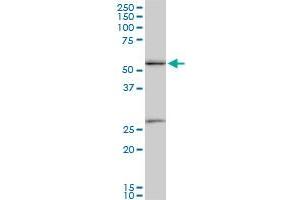 PRPF19 monoclonal antibody (M07), clone 2E5. (PRP19 antibody  (AA 1-90))