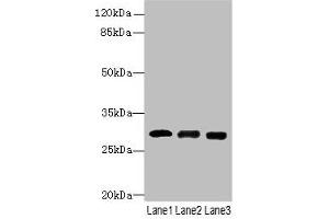 Western blot All lanes: CELA3A antibody at 14 μg/mL Lane 1: Mouse heart tissue Lane 2: Mouse skeletal muscle tissue Lane 3: Jurkat whole cell lysate Secondary Goat polyclonal to rabbit IgG at 1/10000 dilution Predicted band size: 30 kDa Observed band size: 30 kDa (Elastase 3A antibody  (AA 29-270))