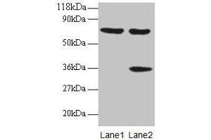Western blot All lanes: SYNCRIP antibody at 2 μg/mL Lane 1: EC109 whole cell lysate Lane 2: 293T whole cell lysate Secondary Goat polyclonal to rabbit IgG at 1/15000 dilution Predicted band size: 70, 66, 63, 59, 47 kDa Observed band size: 70, 36 kDa (SYNCRIP antibody  (AA 2-191))