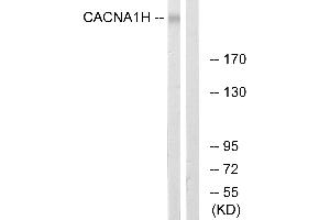 Western blot analysis of extracts from A549 cells, using CACNA1H antibody. (CACNA1H antibody  (Internal Region))