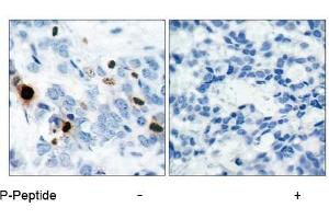 Image no. 1 for anti-Histone H3.1 (HIST1H3B) (pSer10) antibody (ABIN196922) (Histone H3.1 antibody  (pSer10))