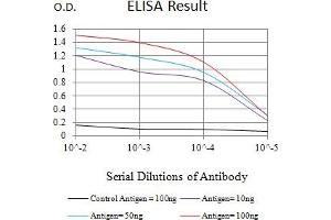 Black line: Control Antigen (100 ng),Purple line: Antigen (10 ng), Blue line: Antigen (50 ng), Red line:Antigen (100 ng) (WT1 antibody  (AA 1-181))