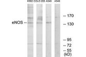 Western blot analysis of extracts from A549/K562/COLO205 cells, using eNOS (Ab-1179) Antibody. (ENOS antibody  (AA 1145-1194))