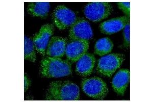 IF analysis of NOV/CCN3 using anti-NOV/CCN3 antibody (ABIN5518938). (NOV antibody  (C-Term))