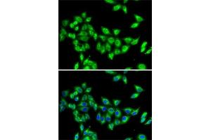 Immunofluorescence analysis of MCF7 cells using KIF3A antibody (ABIN6128170, ABIN6142871, ABIN6142872 and ABIN6222335). (KIF3A antibody  (AA 430-699))