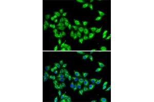 Immunofluorescence analysis of MCF7 cells using KIF3A antibody (ABIN6128170, ABIN6142871, ABIN6142872 and ABIN6222335). (KIF3A antibody  (AA 430-699))