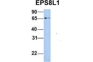 Host:  Rabbit  Target Name:  EPS8L1  Sample Type:  293T  Antibody Dilution:  1. (EPS8-Like 1 antibody  (Middle Region))