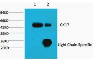 Immunoprecipitation (IP) analysis: 1) Input: HeLa Cell Lysate. (KRT17 antibody)