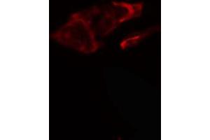 ABIN6266880 staining HeLa cells by IF/ICC. (COL5A1 antibody  (N-Term))