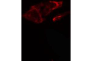 ABIN6266880 staining HeLa cells by IF/ICC.