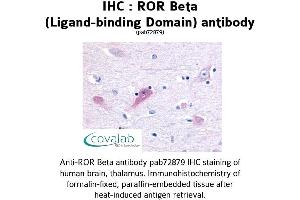 Image no. 1 for anti-RAR-Related Orphan Receptor B (RORB) antibody (ABIN1738927) (RORB antibody)