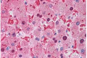 Human Liver (formalin-fixed, paraffin-embedded) stained with XIAP antibody ABIN214586 at 2 ug/ml followed by biotinylated goat anti-rabbit IgG secondary antibody ABIN481713, alkaline phosphatase-streptavidin and chromogen. (XIAP antibody  (C-Term))