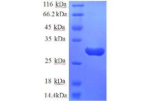SDS-PAGE (SDS) image for Tachykinin Receptor 1 (TACR1) (AA 1-29), (Extracellular) protein (GST tag) (ABIN5712696)