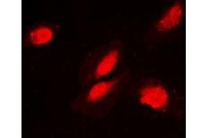 Immunofluorescent analysis of FKBP3 staining in MCF7 cells. (FKBP3 antibody)