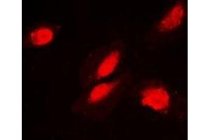 Immunofluorescent analysis of FKBP3 staining in MCF7 cells.