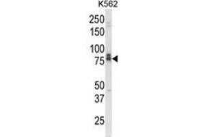 Western blot analysis of IL18RAP Antibody (N-term) in K562 cell line lysates (35ug/lane). (IL18RAP antibody  (N-Term))