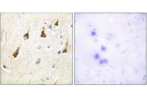 Immunohistochemistry analysis of paraffin-embedded human brain tissue, using SENP7 Antibody. (SENP7 antibody  (AA 991-1040))