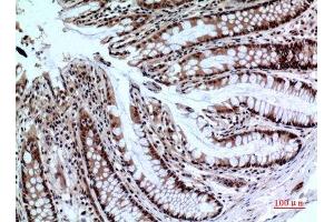 Immunohistochemistry (IHC) analysis of paraffin-embedded Human Colon, antibody was diluted at 1:100. (NKp44/NCR2 antibody  (Internal Region))