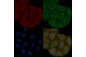 Inhibin beta B Mouse Monoclonal Antibody staining Hela cells by IF/ICC.