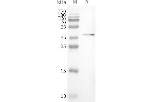 WB analysis of Human PVRIG-Nanodisc with anti-Flag monoclonal antibody at 1/5000 dilution, followed by Goat Anti-Rabbit IgG HRP at 1/5000 dilution (PVRIG Protein)