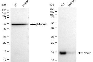 Western blotting analysis using AP2S1 antibody (ABIN7797510).
