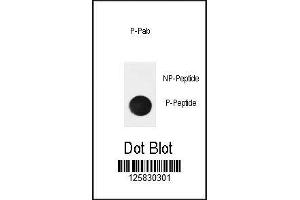 Dot Blot (DB) image for anti-Nuclear Factor of kappa Light Polypeptide Gene Enhancer in B-Cells Inhibitor, alpha (NFKBIA) (pSer32) antibody (ABIN3032050)
