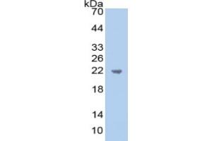 Western Blotting (WB) image for alpha 1 Microglobulin/bikunin precursor (AMBP) ELISA Kit (ABIN6574148)