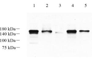 Western blot analysis of LRIG1 (ABIN7074488),at dilution of 1: 1000,Lane 1: Mouse brain tissue lysate,Lane 2: Mouse cerebellum tissue lysate,Lane 3: Mouse skin tissue lysate,Lane 4: Rat brain tissue lysate,Lane 5: Rat cerebellum tissue lysate (Lrig1 antibody)