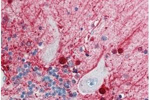 Human Brain, Cerebellum (formalin-fixed, paraffin-embedded) stained with CASP5 antibody ABIN214433 at 5 ug/ml followed by biotinylated goat anti-rabbit IgG secondary antibody ABIN481713, alkaline phosphatase-streptavidin and chromogen. (CASP5 antibody)
