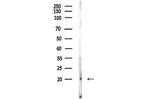 anti-Ras Homolog Enriched in Brain (RHEB) (Internal Region) antibody