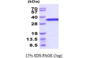 SDS-PAGE (SDS) image for Eukaryotic Translation Initiation Factor 4E (EIF4E) (AA 1-217) protein (His tag) (ABIN6387994)