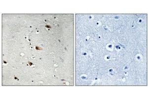 Immunohistochemical analysis of paraffin-embedded human brain tissue using E2A (Phospho-Thr355) antibody (left)or the same antibody preincubated with blocking peptide (right). (TCF3 antibody  (pThr355))