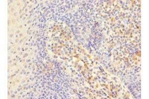 Immunohistochemistry of paraffin-embedded human tonsil tissue using ABIN7156455 at dilution of 1:100 (CD103 antibody  (AA 19-200))