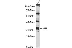 Western blot analysis of extracts of LO2 cells, using MFF antibody (ABIN6132274, ABIN6143787, ABIN6143789 and ABIN6216008) at 1:3000 dilution. (MFF antibody  (AA 15-170))