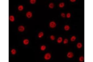 ABIN6266647 staining 293 by IF/ICC. (SAE1 antibody  (Internal Region))