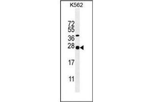 Western blot analysis of Galanin Antibody (Center) in K562 cell line lysates (35ug/lane).