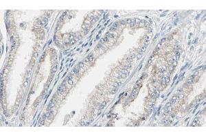 ABIN6269292 at 1/100 staining Human prostate tissue by IHC-P. (Calmodulin 1 antibody)