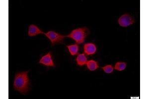 HEK 293 stained with Rad51 Polyclonal Antibody, Unconjugated  at 1:500 in PBS and incubated for one hour at room temperature, followed by secondary antibody incubation, DAPI staining of the nuclei and detection. (RAD51 antibody  (AA 81-180))