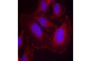 Immunofluorescence staining of methanol-fixed HeLa cells using PLC-γ1 (phospho-Tyr771) Antibody (E011523, Red) (Phospholipase C gamma 1 antibody  (pTyr771))