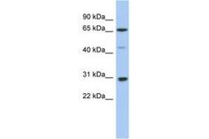 Image no. 1 for anti-Protein Inhibitor of Activated STAT, 3 (PIAS3) (AA 395-444) antibody (ABIN6742316) (PIAS3 antibody  (AA 395-444))