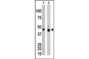 The anti-CKB Pab (ABIN391073 and ABIN2841220) is used in Western blot to detect CKB in mouse colon tissue lysate (Lane 1) and Y79 cell lysate (Lane 2). (CKB antibody  (N-Term))
