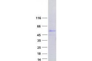 Testis Specific Protein, Y-Linked 4 (TSPY4) protein (Myc-DYKDDDDK Tag)