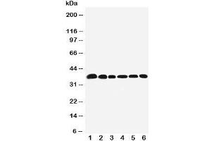 Western blot testing of Nucleophosmin antibody and Lane 1:  rat testis;  2: (r) brain;  3: human HeLa;  4: (h) U87;  5: (h)A549;  6: (h) SMMC-7721 cell lysate. (NPM1 antibody  (N-Term))