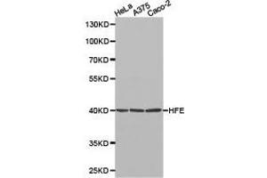 Western Blotting (WB) image for anti-Hemochromatosis (HFE) antibody (ABIN1872964) (HFE antibody)