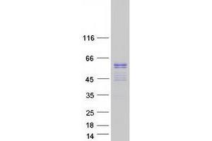 Validation with Western Blot (ERG Protein (Transcript Variant 2) (Myc-DYKDDDDK Tag))