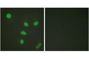 Immunofluorescence analysis of HeLa cells, using Histone H3 (Acetyl-Lys27) Antibody. (Histone 3 antibody  (H3K27ac))